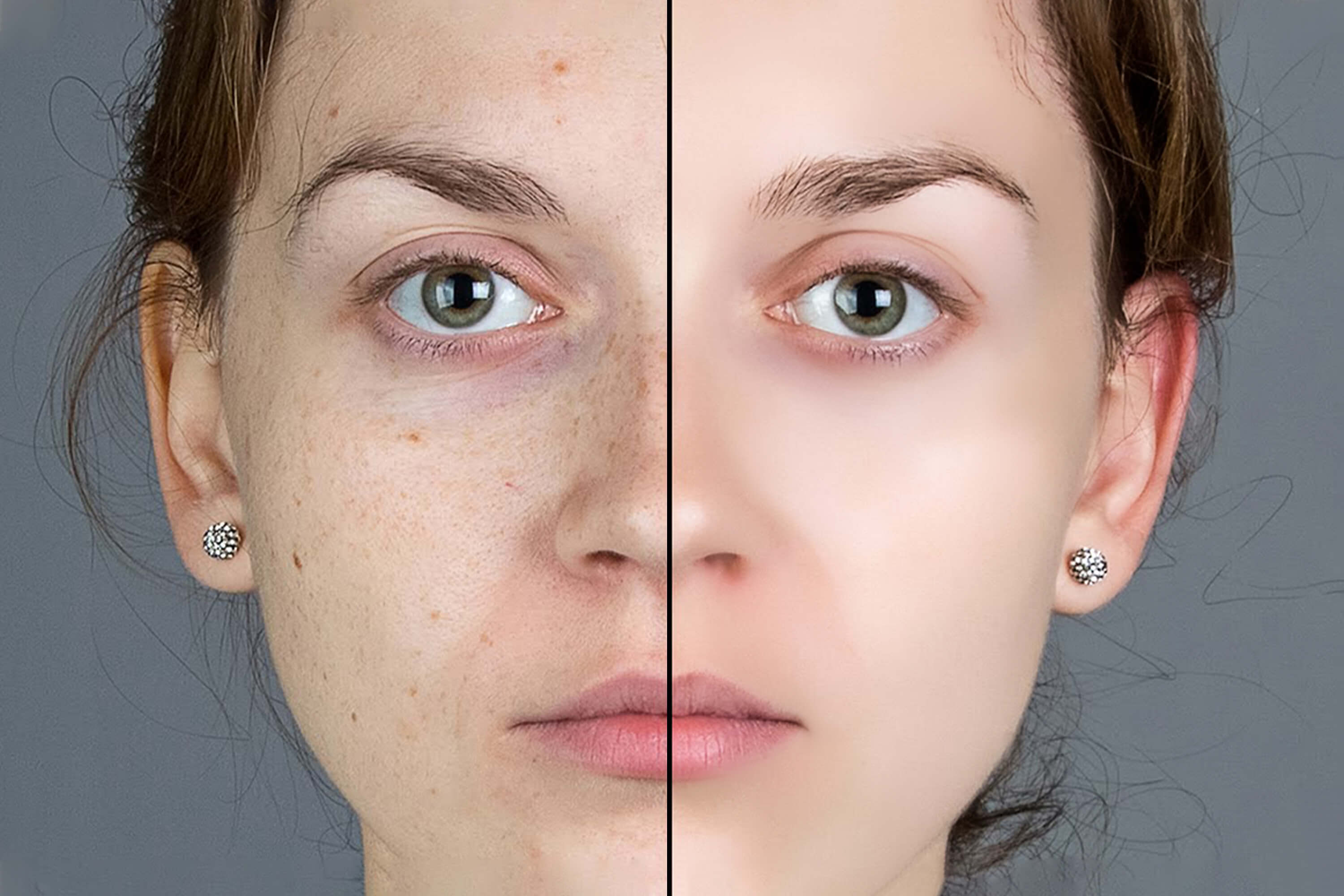 Skin Smoothing, Softening in USA